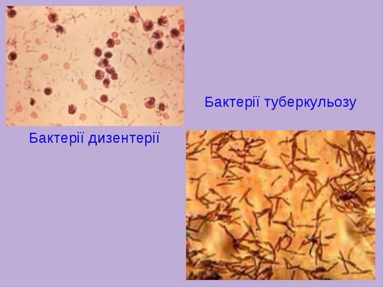 Бактерії дизентерії Бактерії туберкульозу