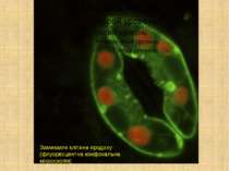 Замикаючі клітини продиху (флуоресцентна конфокальна мікроскопія)