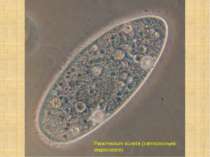 Paramecium aurelia (світлопольна мікроскопія)