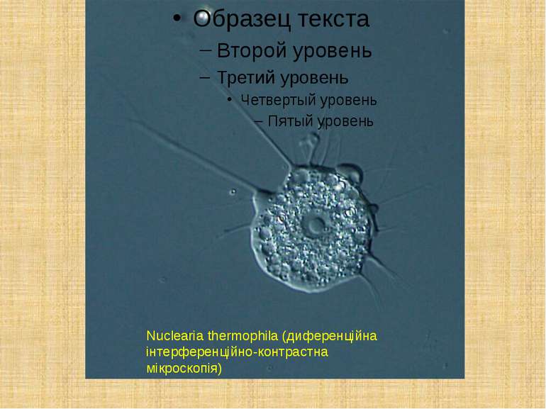 Nuclearia thermophila (диференційна інтерференційно-контрастна мікроскопія)