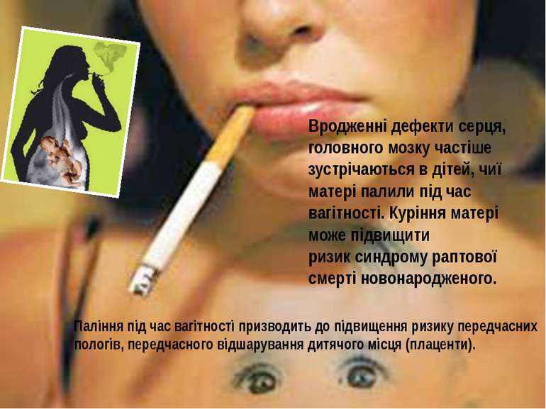 Паління під час вагітності призводить до підвищення ризику передчасних пологі...