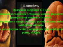 5 тиждень Довжина ембріона 6-9 мм. Развіваются головний і спинний мозок, форм...