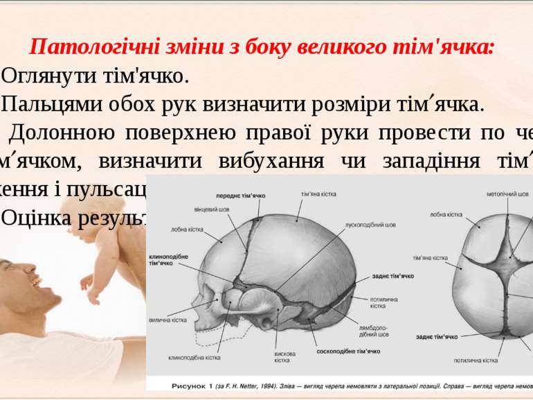 Патологічні зміни з боку великого тім'ячка: 1 етап. Оглянути тім'ячко. 2 етап...