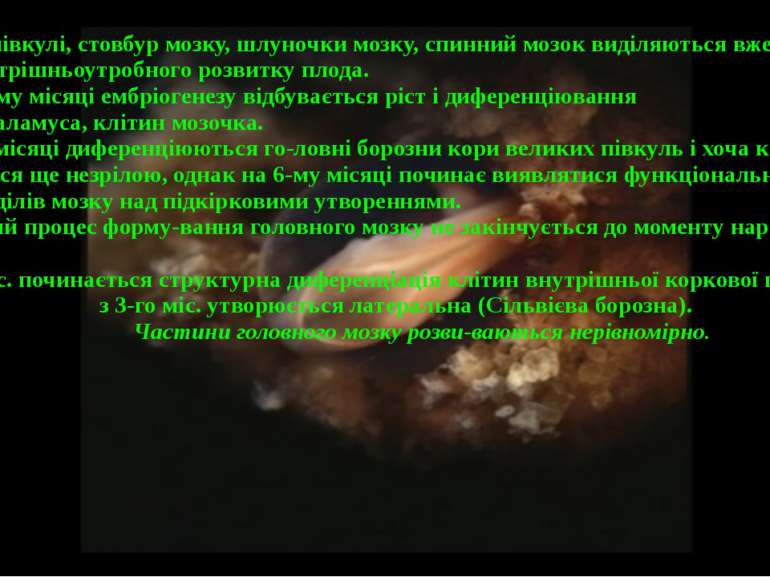 Великі півкулі, стовбур мозку, шлуночки мозку, спинний мозок виділяються вже ...