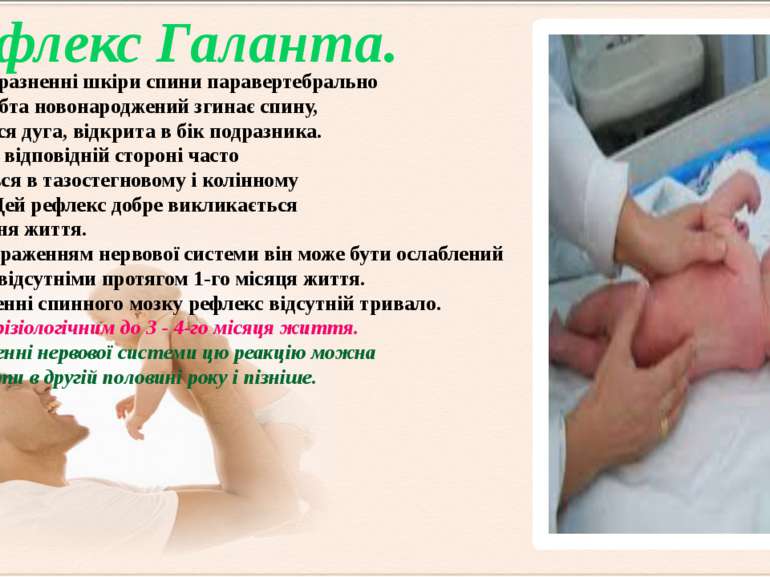 При подразненні шкіри спини паравертебрально вздовж хребта новонароджений зги...