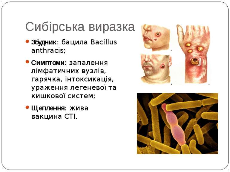 Сибірська виразка Збудник: бацила Bacillus anthracis; Симптоми: запалення лім...