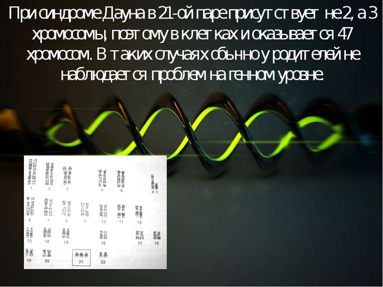 При синдроме Дауна в 21-ой паре присутствует не 2, а 3 хромосомы, поэтому в к...