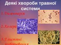 Деякі хвороби травної системи Дизентерія Холера Глистяні захворювання