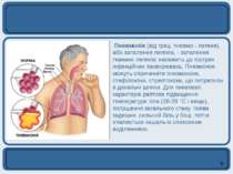 Пневмонія (від грец. пневмо - легеня), або запалення легенів, - запалення тка...