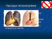 Наслідки тютюнопаління Легені – утруднюється дихання; виникає “кашель курця” ...