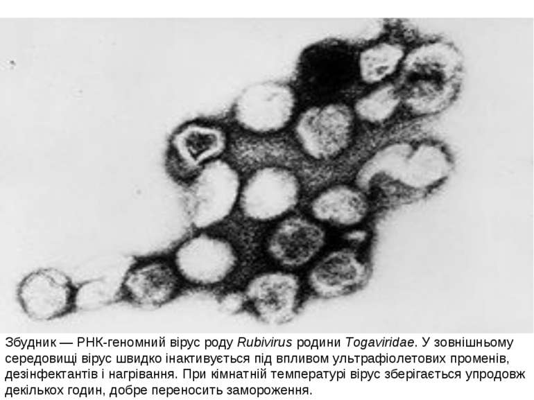 Збудник — РНК-геномний вірус роду Rubivirus родини Togaviridae. У зовнішньому...
