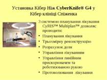 Установка Кібер Ніж CyberKnife® G4 у Кібер клініці Спіженка З системою планув...
