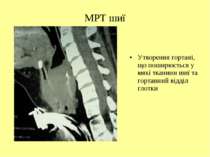 МРТ шиї Утворення гортані, що поширюється у мякі тканини шиї та гортанний від...