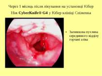 Через 1 місяць після лікування на установці Кібер Ніж CyberKnife® G4 у Кібер ...