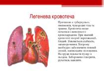 Легенева кровотеча Причиною є туберкульоз, пневмонія, чужородні тіла та травм...