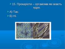 15. Прокаріоти – організми які мають ядро. А) Так; Б) Ні.