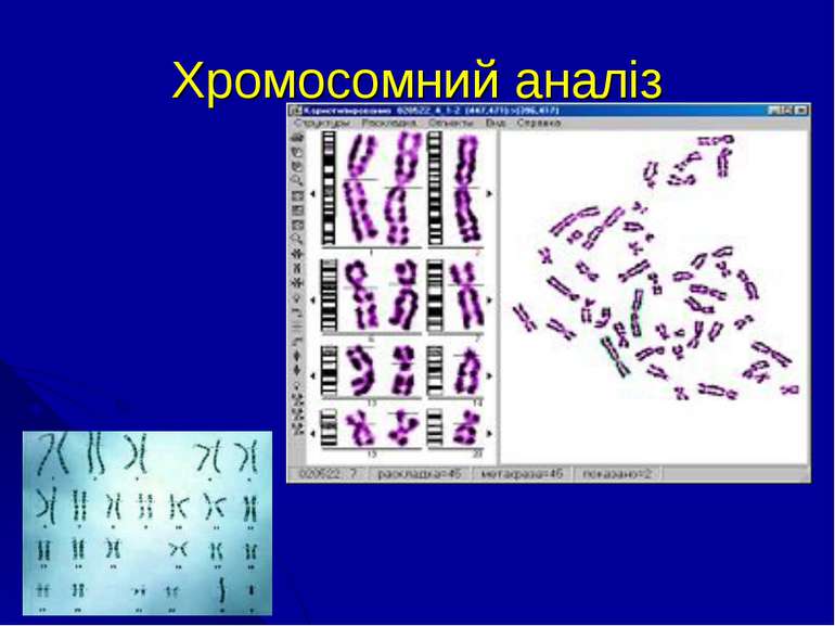 Хромосомний аналіз