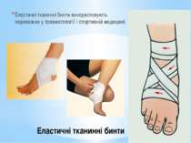 Еластичні тканинні бинти використовують переважно у травматології і спортивні...