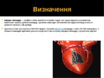 Визначення Інфаркт міокарда — крайня ступінь ішемічної хвороби серця, яка хар...