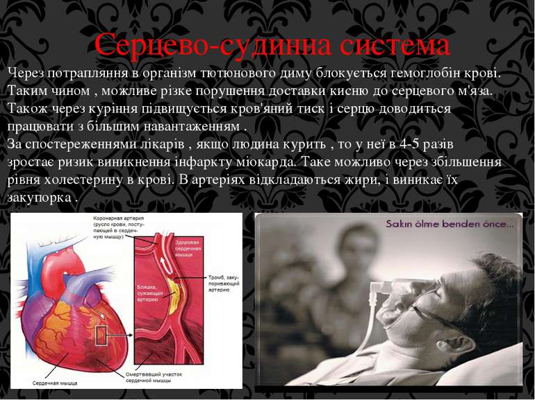 Серцево-судинна система Через потрапляння в організм тютюнового диму блокуєть...