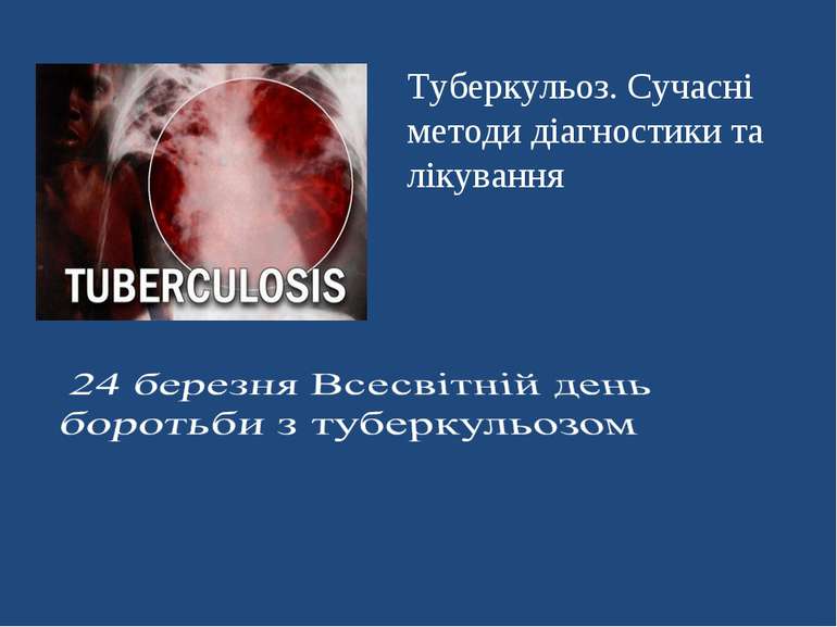 Туберкульоз. Сучасні методи діагностики та лікування