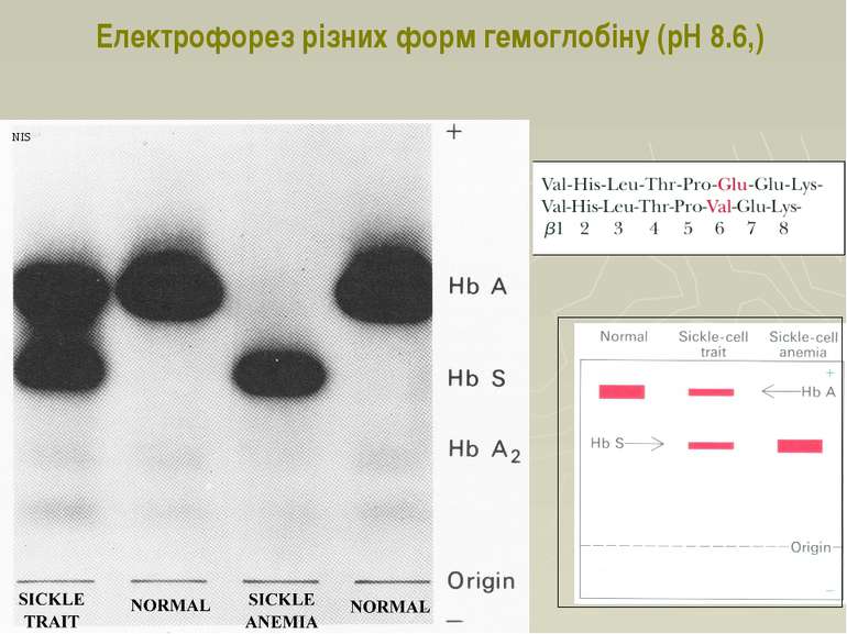 Electrophoresis of HbS NIS Електрофорез різних форм гемоглобіну (pH 8.6,)