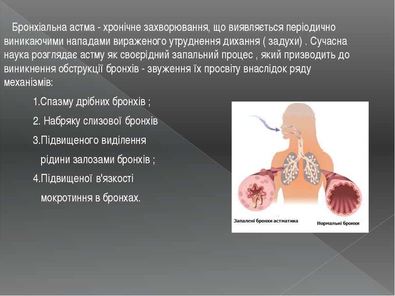 Бронхіальна астма - хронічне захворювання, що виявляється періодично виникаюч...