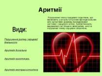 Аритмії Порушення темпу серцевих скорочень, що виникають у результаті різних ...