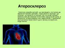 Атеросклероз Хронічна хвороба артерій, що призводить поступово до звуження пр...