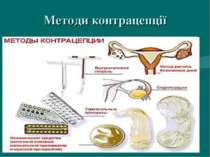 Методи контрацепції