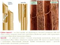Судини (трахеї) — це довгі трубки, що формуються з багатьох розміщених одна н...