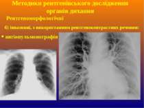 б) інвазивні, з використанням рентгеноконтрастних речовин: ангіопульмонографі...