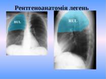 Рентгеноанатомія легень