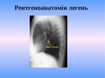 Рентгеноанатомія легень