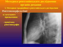 Методики рентгенівського дослідження органів дихання