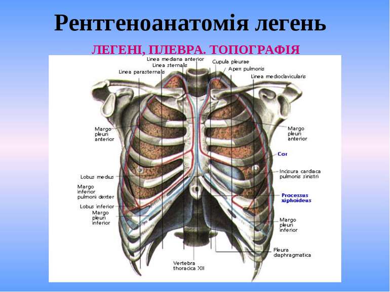 Рентгеноанатомія легень ЛЕГЕНІ, ПЛЕВРА. ТОПОГРАФІЯ