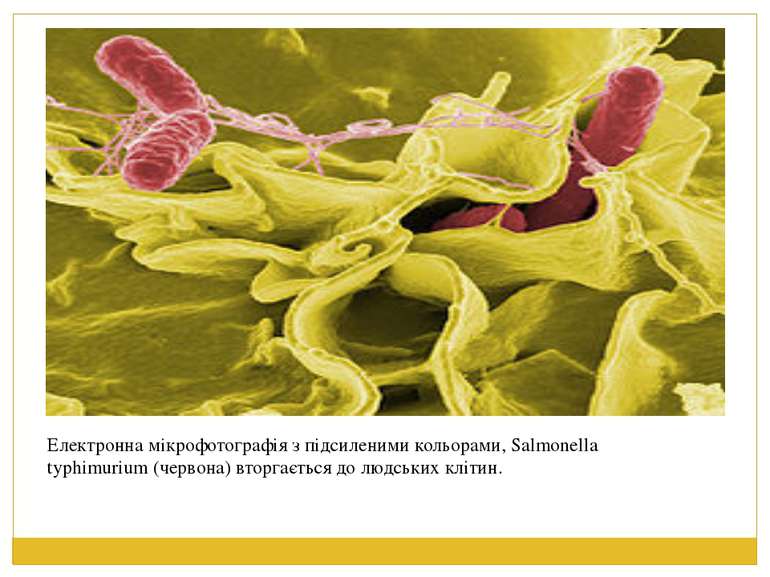 Електронна мікрофотографія з підсиленими кольорами, Salmonella typhimurium (ч...