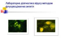 Лабораторна діагностика вірусу методом флуоресціюючих антитіл