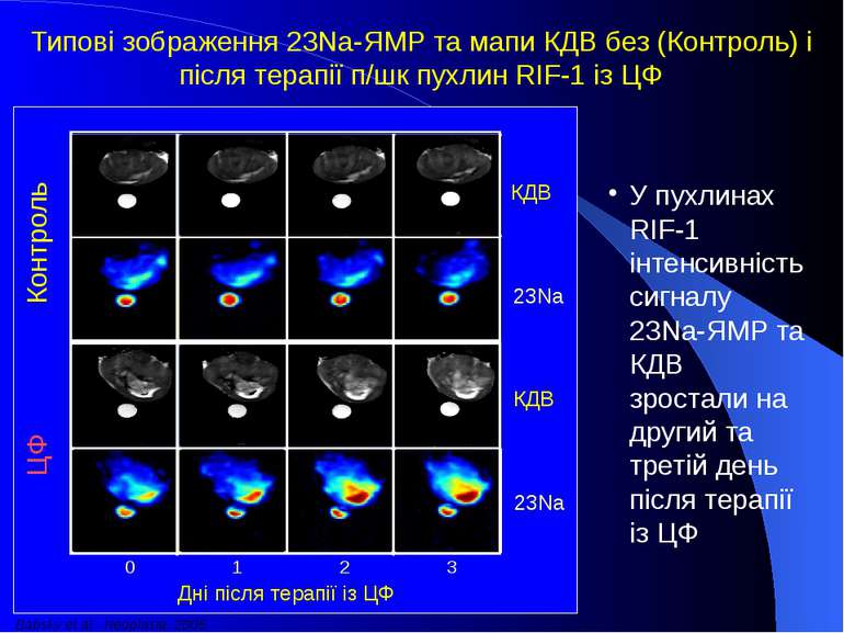 Контроль ЦФ 0 1 2 3 Дні після терапії із ЦФ 23Na КДВ 23Na КДВ У пухлинах RIF-...