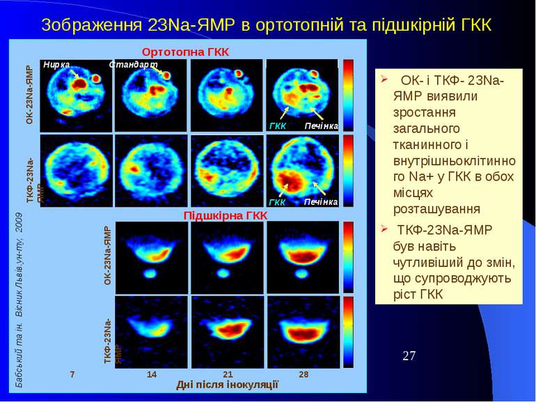 Зображення 23Na-ЯМР в ортотопній та підшкірній ГКК 14 21 28 Дні після інокуля...