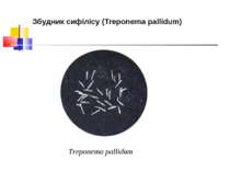 Збудник сифілісу (Treponema pallidum) Treponema pallidum