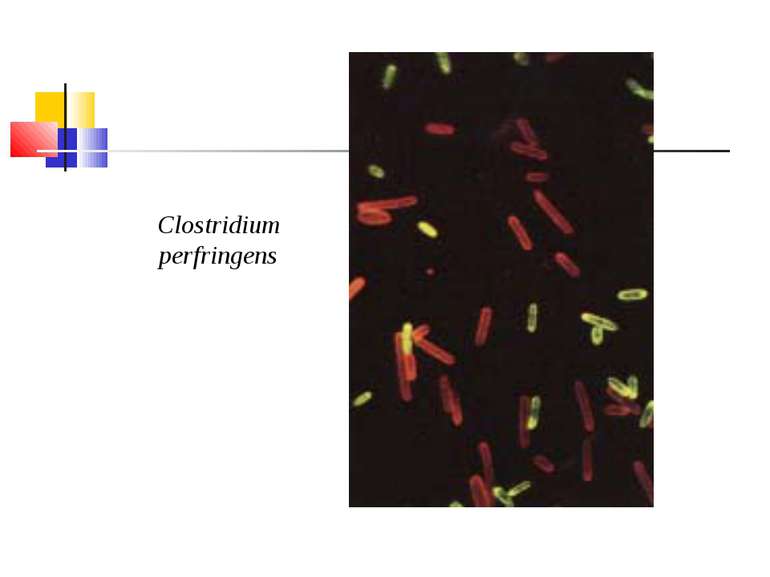 Clostridium perfringens