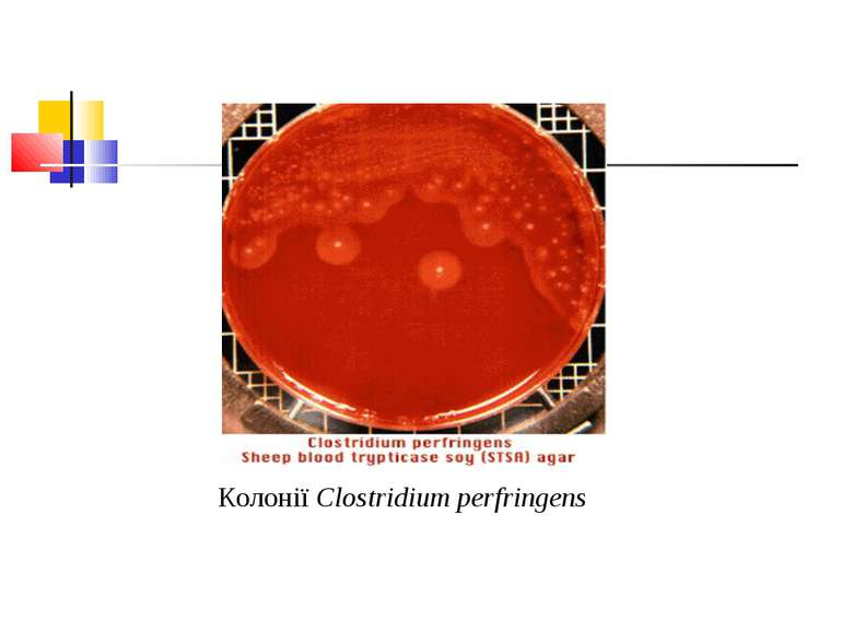 Колонії Clostridium perfringens