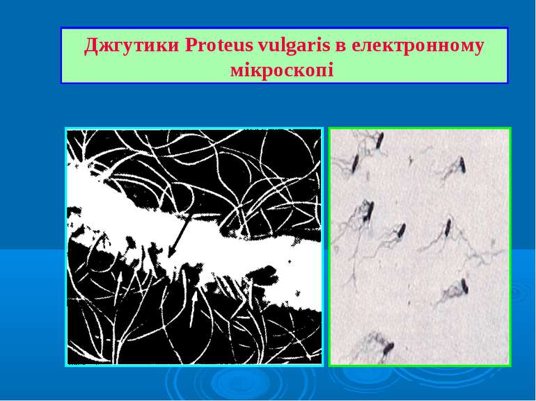 Джгутики Proteus vulgaris в електронному мікроскопі