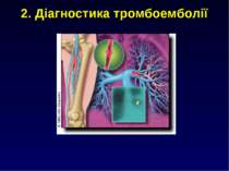 2. Діагностика тромбоемболії