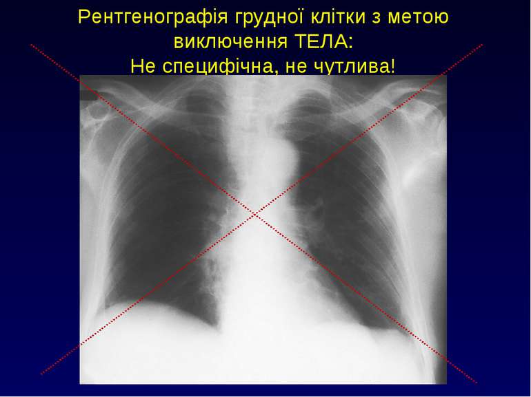 Рентгенографія грудної клітки з метою виключення ТЕЛА: Не специфічна, не чутл...
