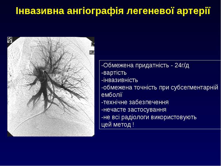 Інвазивна ангіографія легеневої артерії -Обмежена придатність - 24г/д -вартіс...