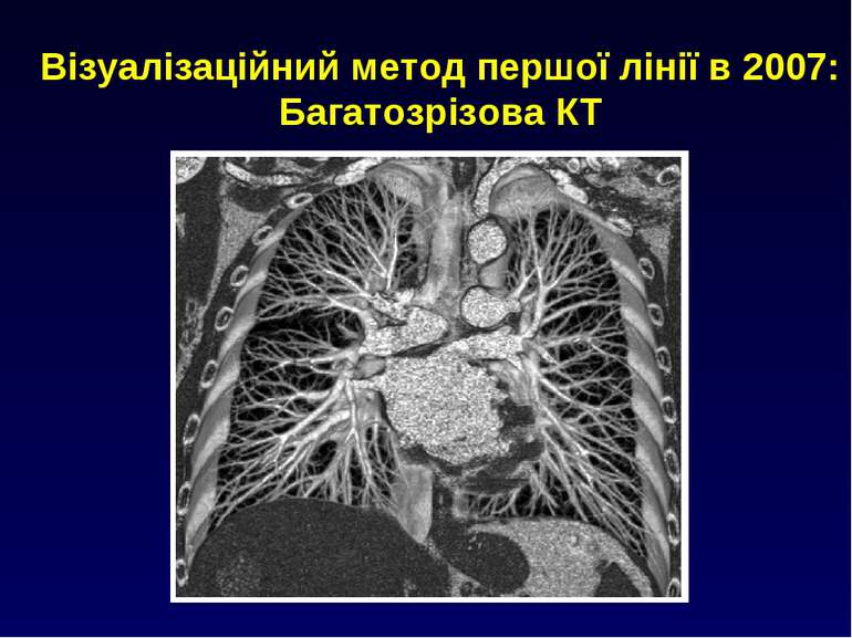 Візуалізаційний метод першої лінії в 2007: Багатозрізова КТ