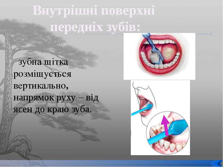 зубна щітка розміщується вертикально, напрямок руху – від ясен до краю зуба. ...
