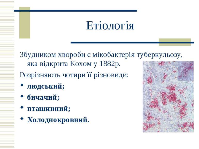 Етіологія Збудником хвороби є мікобактерія туберкульозу, яка відкрита Кохом у...